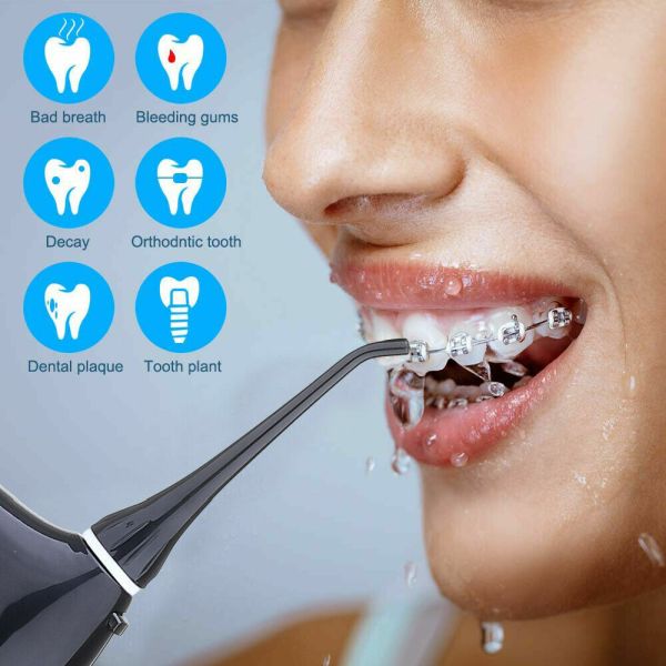 Cordless Water Flosser With 3 Modes (You know, like a Waterpik, but a